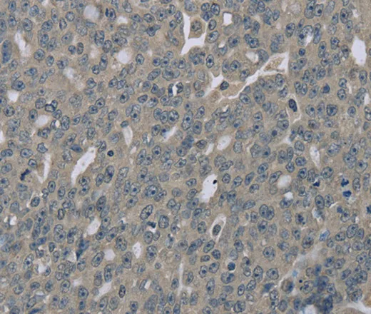 EDN1 Polyclonal Antibody - image 1
