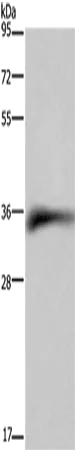 CD32 Polyclonal Antibody - image 1
