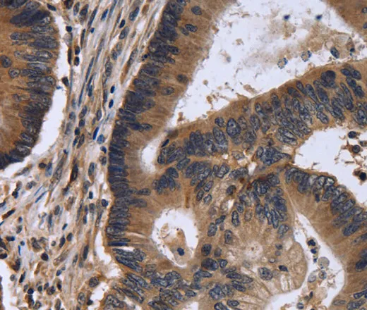 FSTL1 Polyclonal Antibody - image 1
