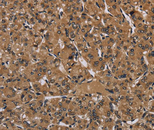 HIF1 alpha Polyclonal Antibody - image 1