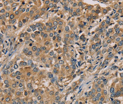 NANOS2 Polyclonal Antibody - image 1