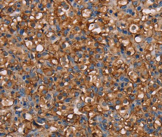 NEDD4L Polyclonal Antibody - image 1