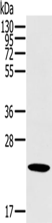 OTUB2 Polyclonal Antibody - image 1