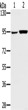 PYGL Polyclonal Antibody - image 1