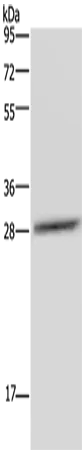 CEBPD Polyclonal Antibody - image 1