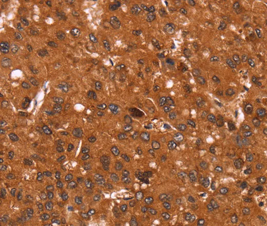 Cyclin D3 Polyclonal Antibody - image 1