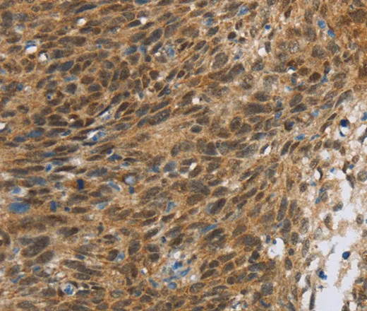 FOXB1 Polyclonal Antibody - image 1