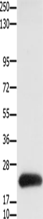Claudin 4 Polyclonal Antibody - image 1