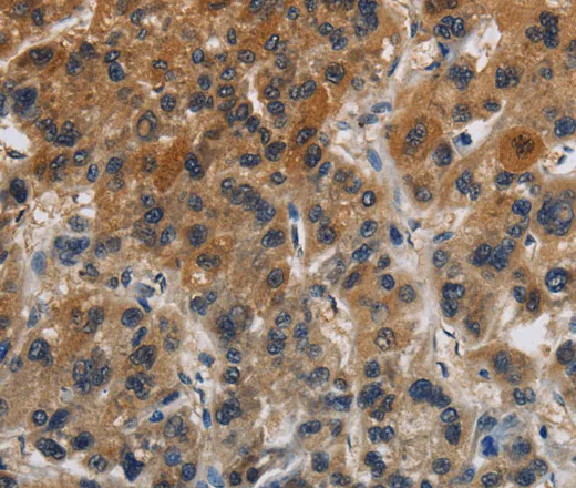 Claudin 8 Polyclonal Antibody - image 1