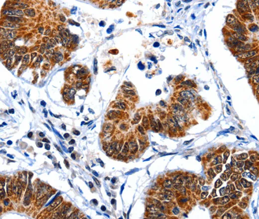GSK3 alpha Polyclonal Antibody - image 1