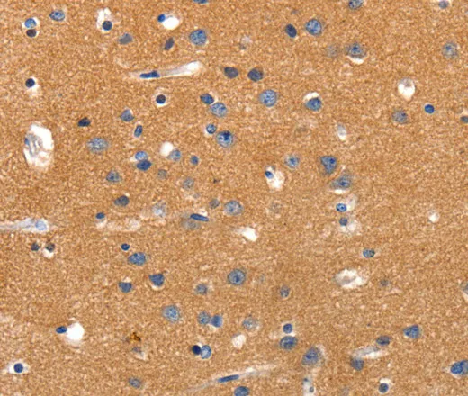 JAK2 Polyclonal Antibody - image 1