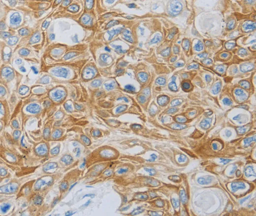 MC5R Polyclonal Antibody - image 1