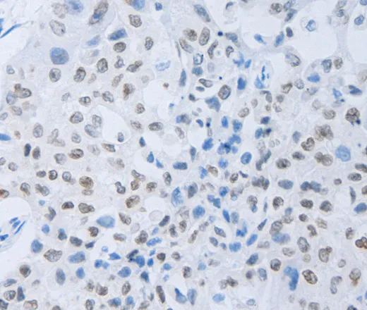 c-Fms Polyclonal Antibody - image 1
