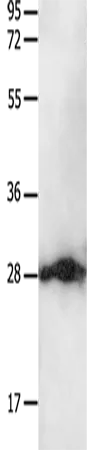 14-3-3 beta/alpha Polyclonal Antibody - image 1