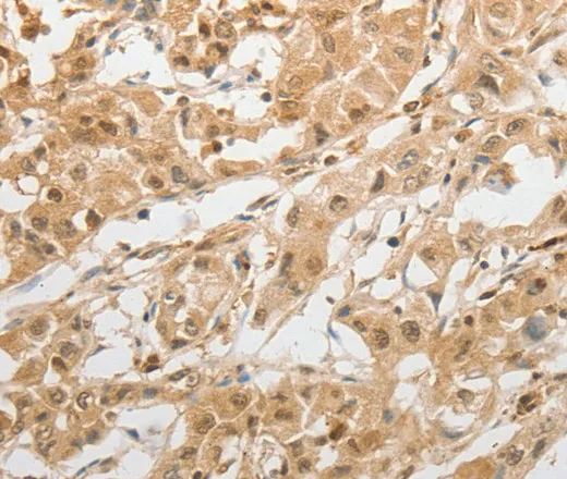 GRIN2C Polyclonal Antibody - image 1