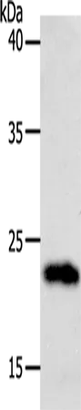 SOCS1 Polyclonal Antibody - image 1