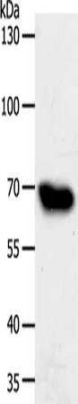 ABCG1 Polyclonal Antibody - image 1