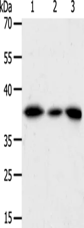 AKR1A1 Polyclonal Antibody - image 1