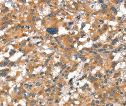 VE-Cadherin Polyclonal Antibody - image 1
