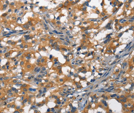 DDR2 Polyclonal Antibody - image 1