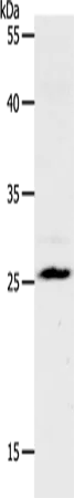 NQO2 Polyclonal Antibody - image 1