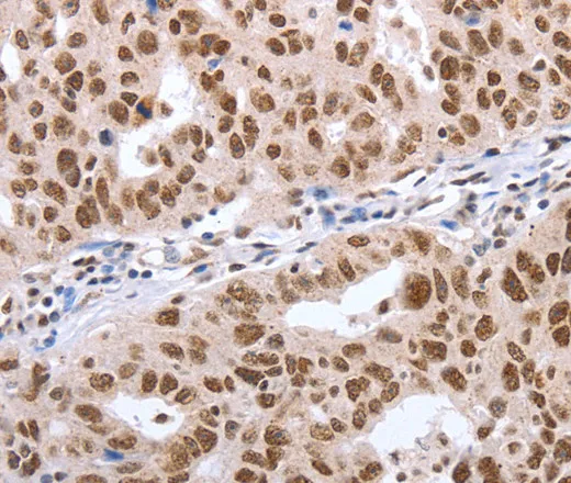 Oct-6 Polyclonal Antibody - image 1