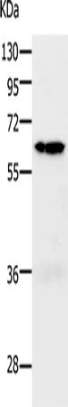 PAK1 Polyclonal Antibody - image 1