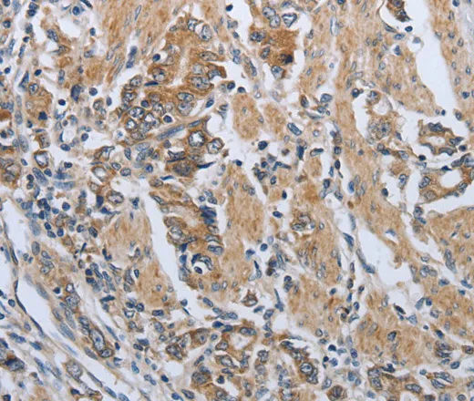 PD-1/CD279 Polyclonal Antibody - image 1