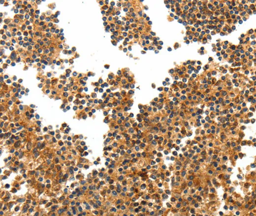 TERT Polyclonal Antibody - image 1