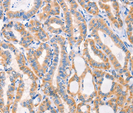 Factor XIIIa Polyclonal Antibody - image 1