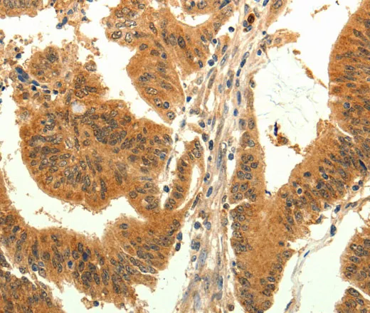 TRPM7 Polyclonal Antibody - image 1