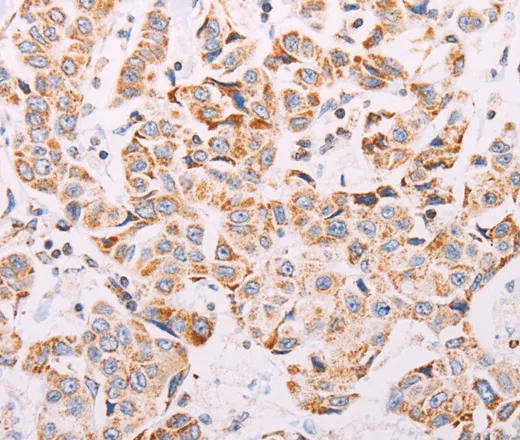 ADAMTS16 Polyclonal Antibody - image 1
