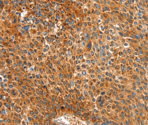 ALDH1A2 Polyclonal Antibody - image 1