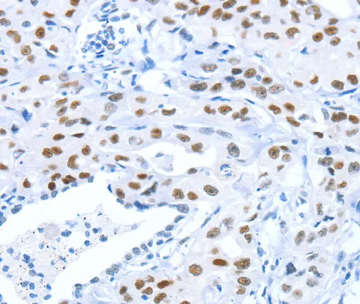 ARID1A Polyclonal Antibody - image 1