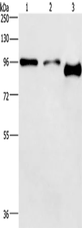 PIP5K1C Polyclonal Antibody - image 1