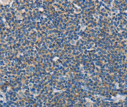 NEK5 Polyclonal Antibody - image 1