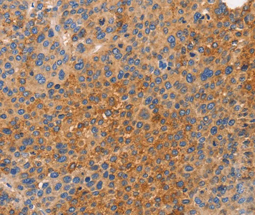 NOD1 Polyclonal Antibody - image 1