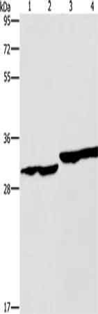 DECR1 Polyclonal Antibody - image 1