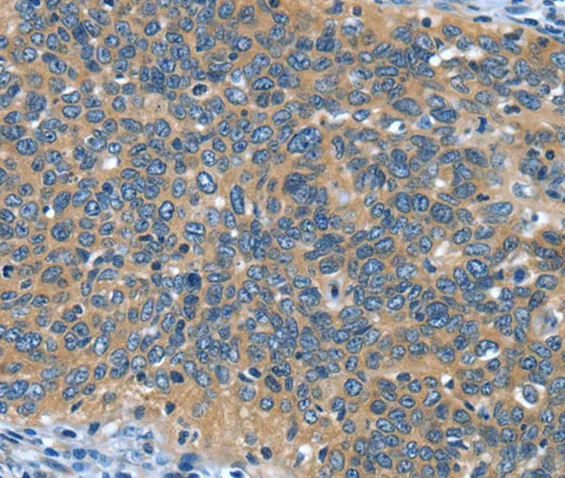 DTX1 Polyclonal Antibody - image 1