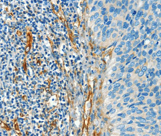 DIO2 Polyclonal Antibody - image 1