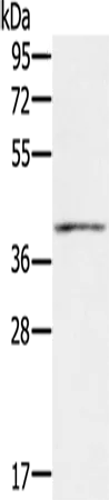 IFNGR2 Polyclonal Antibody - image 1