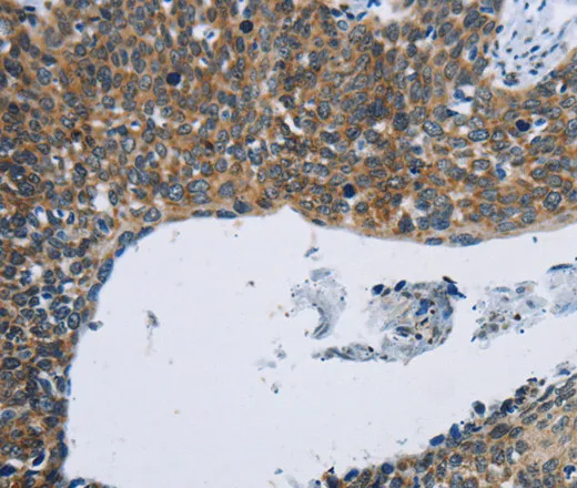KPNB1 Polyclonal Antibody - image 1