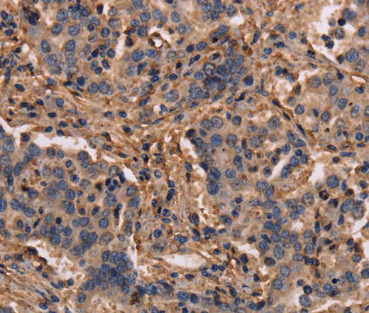 MAP1LC3C Polyclonal Antibody - image 1