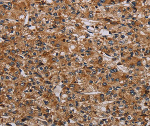 p70 S6 kinase beta Polyclonal Antibody - image 1