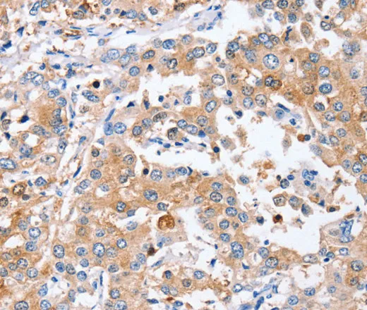 PPOX Polyclonal Antibody - image 1