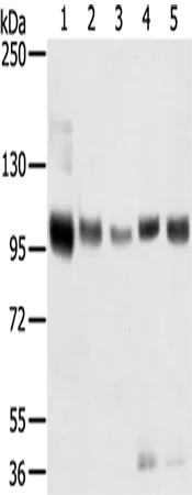 SORT1 Polyclonal Antibody - image 1