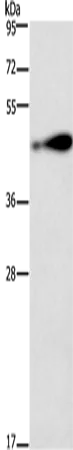 RAGE Polyclonal Antibody - image 1