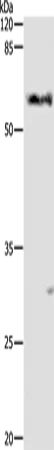 ALDH1A1/2/3 Polyclonal Antibody - image 1
