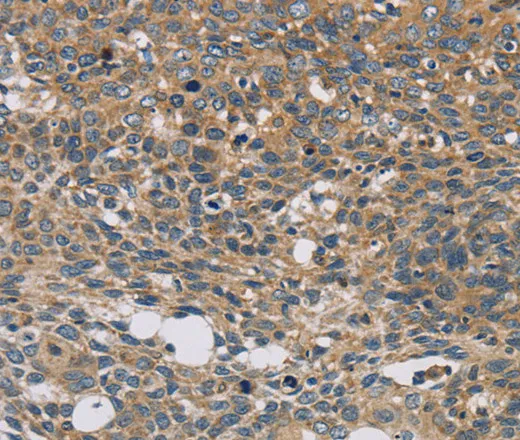 STAT4 Polyclonal Antibody - image 1