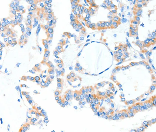 TLR2 Polyclonal Antibody - image 1